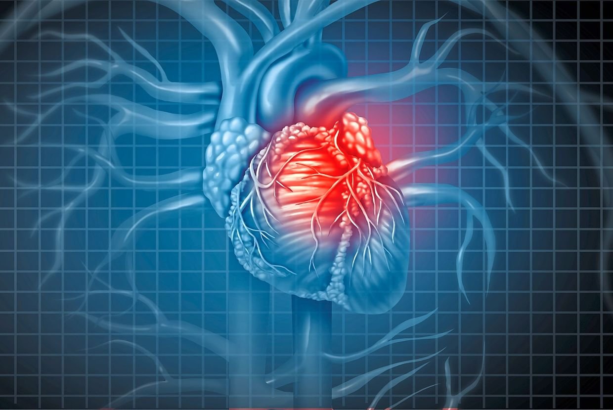 List of 10 Arrhythmia Medications Compared