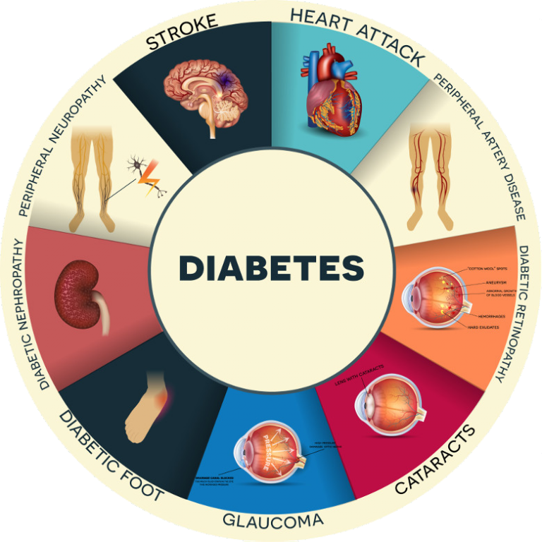 List of Drugs/Medicines Used for Diabetes